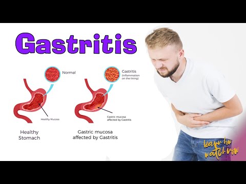 Gastritis | Causes | Signs and symptoms | Foods to avoid gastritis