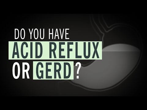 Do You Have Acid Reflux or GERD?