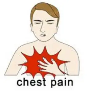 Chest Pain Picture
