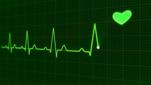 Electrocardiogram